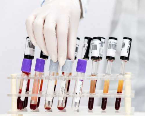 国内试管排名前十名的医院哪家强(国内试管排名前十名的医院哪家强些)